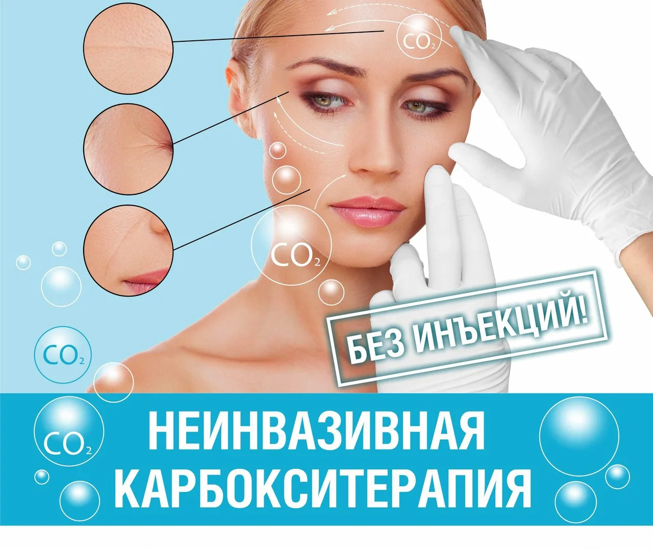 Иллюстрация: Карбокситерапия
